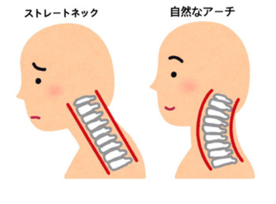 直颈
