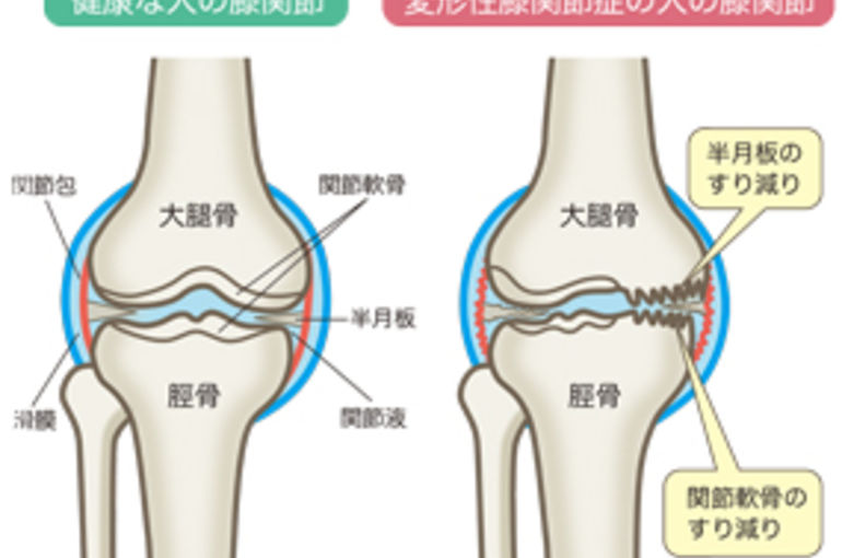 Knee pain