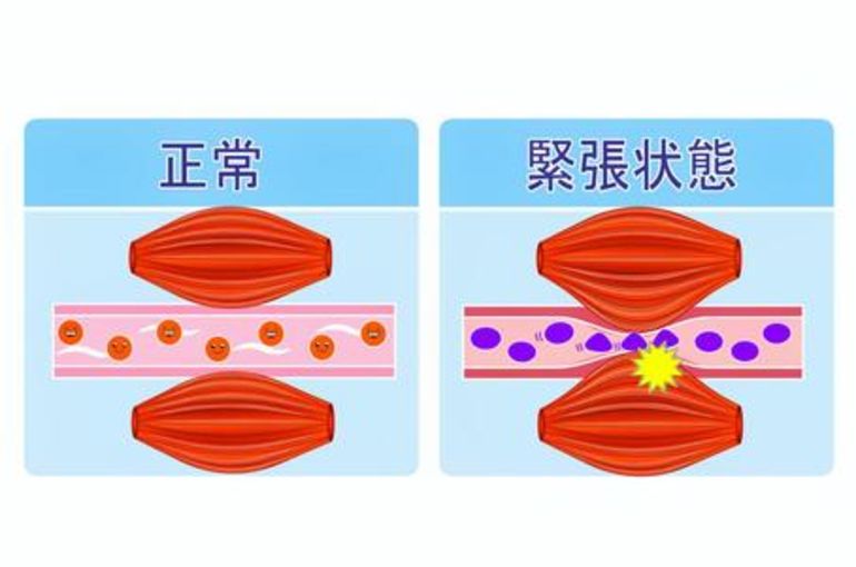 血行不良
