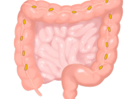 장 면역 하시모토