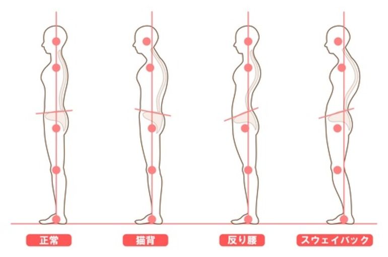 腰痛　姿勢